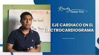CÓMO SACAR EL EJE CARDIACO EN EL ELECTROCARDIOGRAMA
