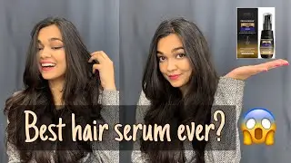 BEST SERUM for HAIRLOSS | Derma Essentia Trichoedge Hair Serum