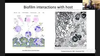 Alex Valm: Structure and Assembly of the Human Oral Microbiome Across Spatial Scales