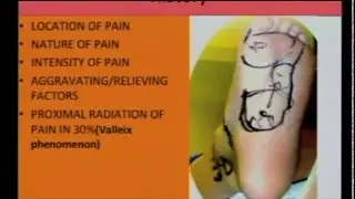 Tarsal tunnel Syndrome