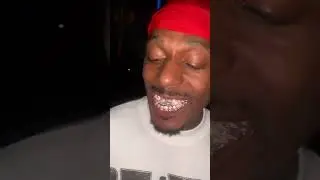 ‼️Texas this one ☝🏾 is for you‼️BEST PERMANENT GRILLZ IN HISTORY‼️