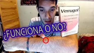 ¿Funciona Verrugol? ¿La recomiendo? - Te dejo mi experiencia !