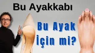 Stilettolar Ayakları Mahvediyor: Halluks Valgus Tehlikesi