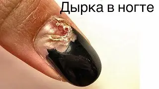 Дырка в ногте. Травма. Наращивание длинных ногтей