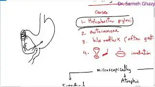 Systemic pathology 22 : GIT 3  ( gastritis ) DR.SAMEH GHAZY