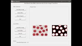Count Red Blood Cells Matlab Source Code GUI