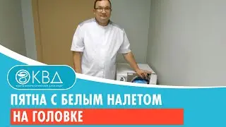 🙁 Пятна с белым налетом на головке. Клинический случай №1031