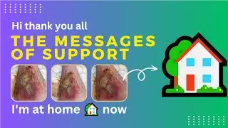 Hi thank you all the messages of support I'm at home 🏡 now