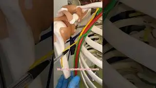 THE HARDEST CONCEPT IN HUMAN ANATOMY! 