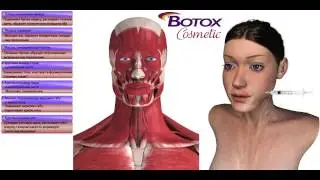 Botox Kozmetik Uygulaması Dr. Mustafa Karataş