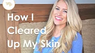 How I Cleared Up My Skin | Skincare and Beauty Tips | Healthy Grocery Girl® PART 1