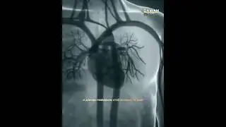 Чёрное сердце..