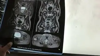 MRI BASIC INTERVIEW
