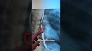 WHATS THE DIAGNOSIS 🤔🤔