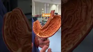 What’s inside your stomach? 
