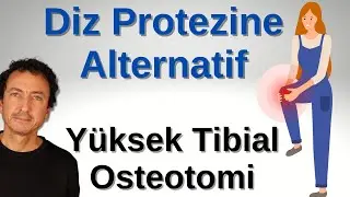 DİZ PROTEZİ YERİNE “YÜKSEK TİBİAL OSTEOTOMİ