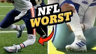 NFL WORST INJURIES - Doctor Explains Joint Dislocations