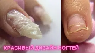 Коррекция ногтей гелем Impuls