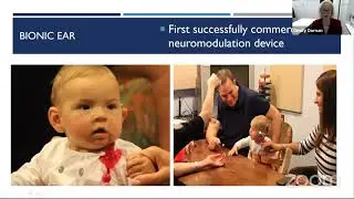 Bionics: Making the improbable Possible