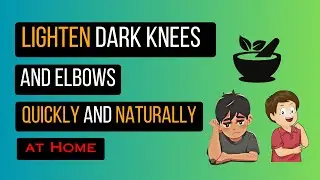 Lighten Dark Knees and Elbows Quickly and Naturally at Home With Kitchen Hacks