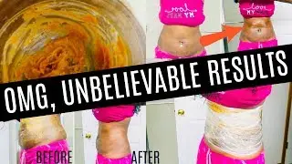 Weight Loss Secret Uncovered | Melts Belly Fat Overnight With This Fat Burning Cream **Must Watch**
