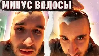 КОРЕШ ПРО%БАЛ ОПЕРАЦИЮ НА ВОЛОСЫ / ПОСЛЕ ОПЕРАЦИИ, Пересадка Волос, Кореш в шоке / ХАЗЯЕВА ВОТЧ
