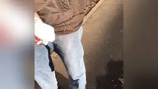 Дело о вживлении детонатора в тело человека