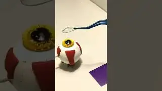 Астигматизм на пальцах 