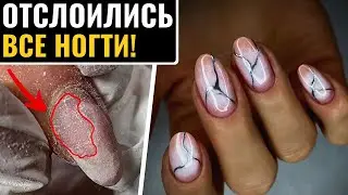 НЕ ОЖИДАЛА! ОТСЛОЙКИ на ВСЕХ НОГТЯХ под покрытием! В чем причина?