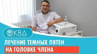 ✅ Лечение темных пятен на головке члена. Клинический случай №985