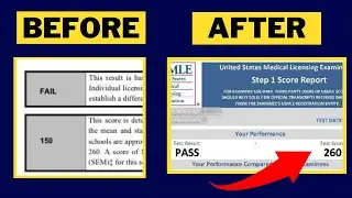 How I Raised My Step 1 Score With One Simple Step