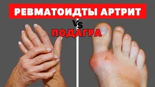 БУЫНЫҢЫЗ СЫРҚЫРАП ҚАТТЫ АУЫРАДЫ МА ?! Денсаулыққа пайдалы кеңестер