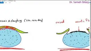 Systemic pathology 29 : GIT 6  ( inflammations of intestine )   DR.SAMEH GHAZY