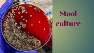 stool culture | stool culture test | stool culture procedure