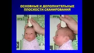 Нейросонография - 1 - Петухов С.В.