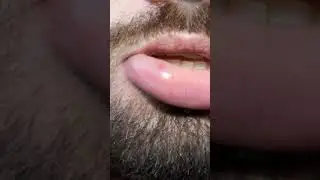Целующийся жук.  Самые опасные насекомые #shorts
