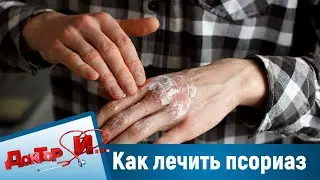 Как лечить псориаз, массаж Мнуши. "Доктор И"