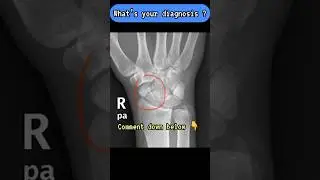 TRY AND DIAGNOSE THIS X-RAY ! 
