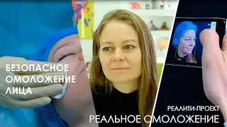 БЕЗОПАСНОЕ омоложение лица / Лазерное омоложение RecoSMA