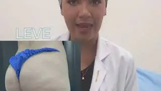 Subcisión, Tratamiento para la Celulits