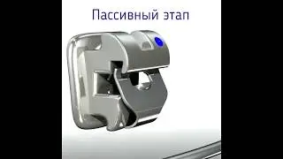 Три этапа лечения на интерактивной самолигирующей системе Experience: