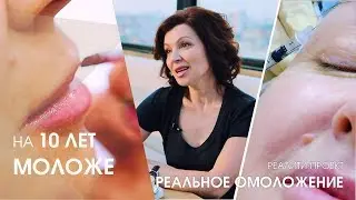 Омоложение лица. Секреты красоты и здоровья. Лазерное омоложение RecoSMA 18+