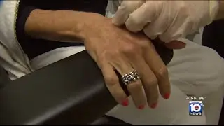 Radiesse for Hand Rejuvenation