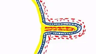chorionic villi by dr sameh ghazy