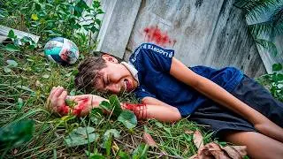 O MOLEQUE QUEBROU O BRAÇO