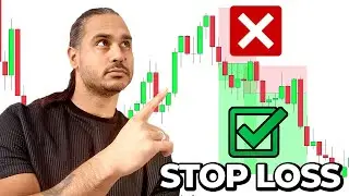 5 RULES You Must Follow When Placing Your STOP LOSS