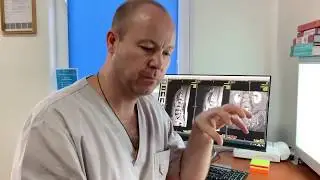 Сакроилеит. Ужас! Хламидии в крестце