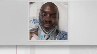 Grady Hospital trying to identify this man who was hit by car last month