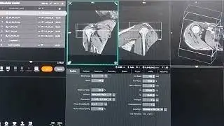 mri shoulder planning practice