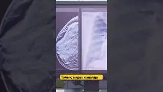 Омырау рагі #шортс
